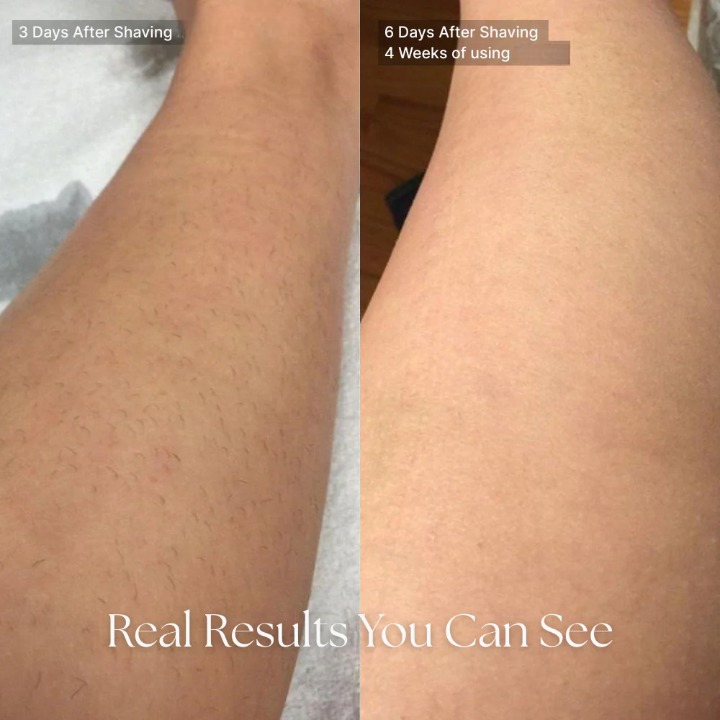 Cyperus Rotundus Oil