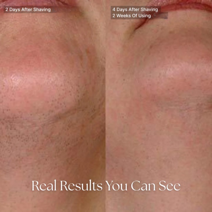 Cyperus Rotundus Oil