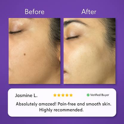 Novella Facial Hair Removal Cream