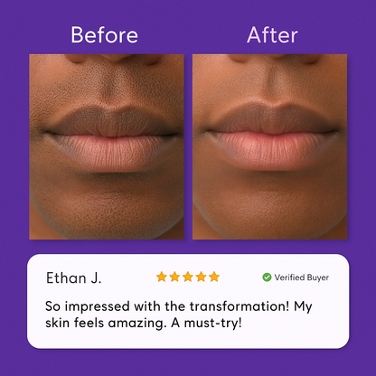 Novella Facial Hair Removal Cream