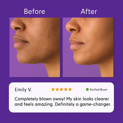 Novella Facial Hair Removal Cream