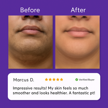 Novella Facial Hair Removal Cream