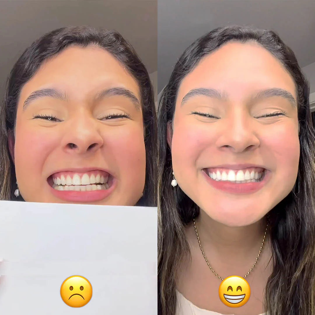 EasySmile™ bleekmiddel