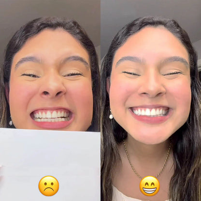 EasySmile™ bleekmiddel