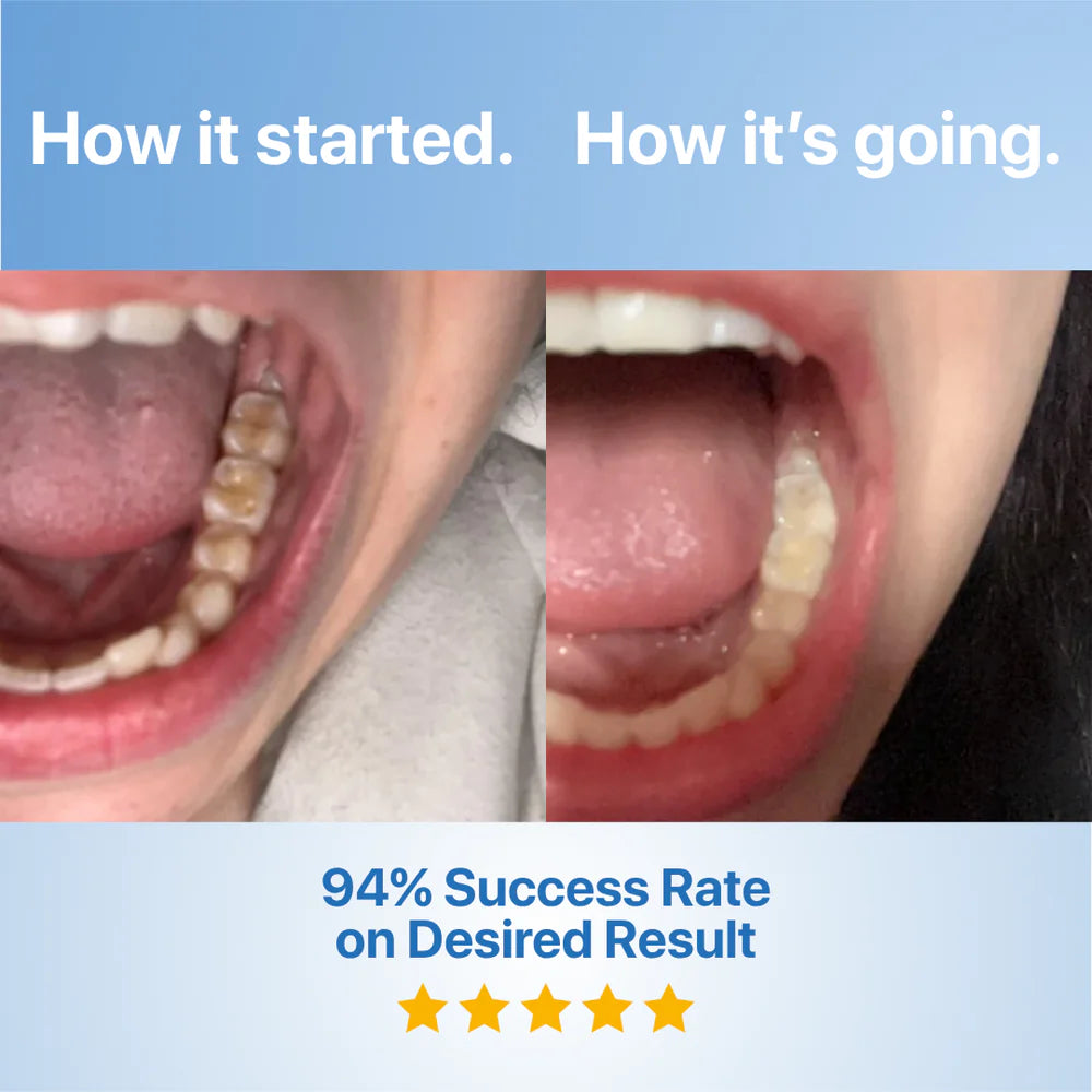 Tooth Whitening Powder